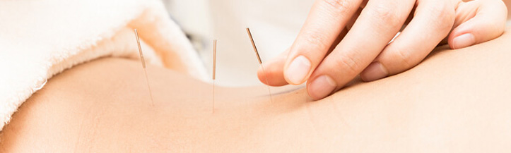 Acupuncture Doctor Delhi